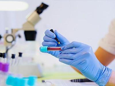 A technologist labelling a blood specimen tube