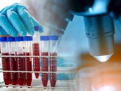A rack of blood specimens beside a microscope